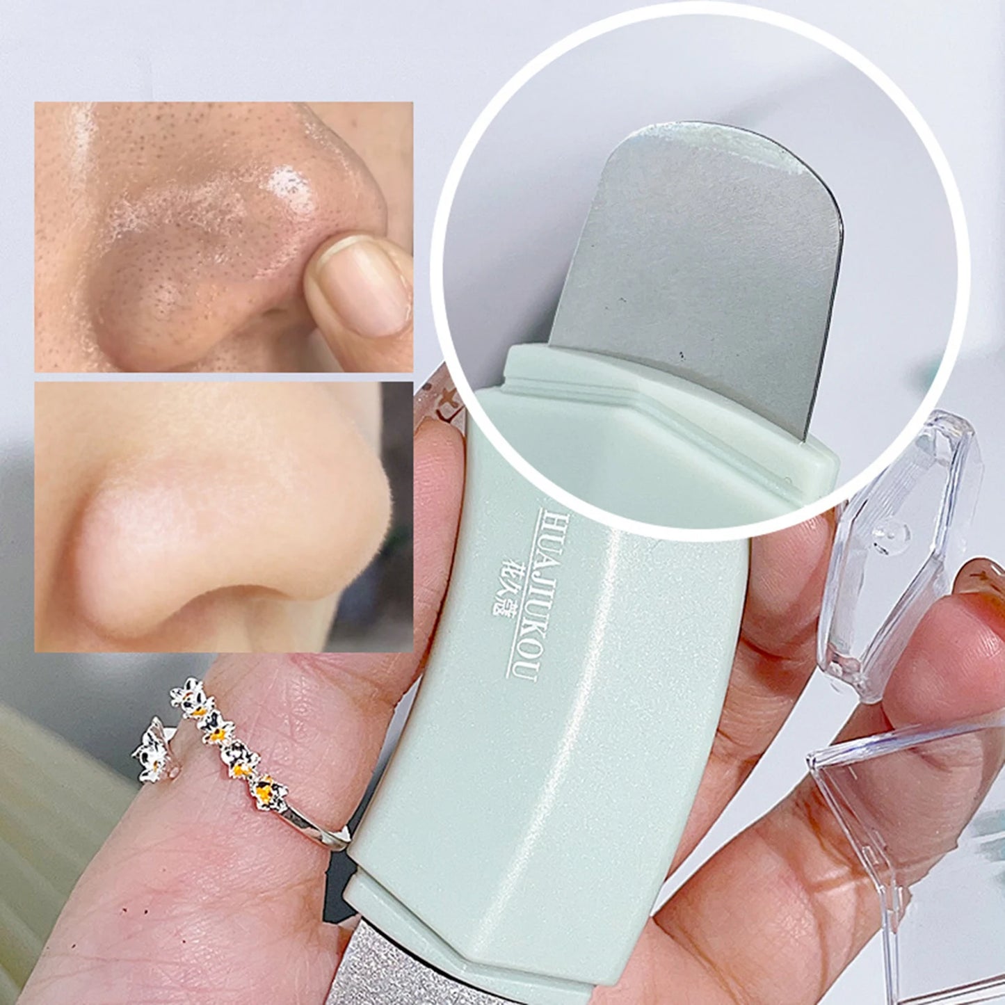 Blackhead Remover Tool