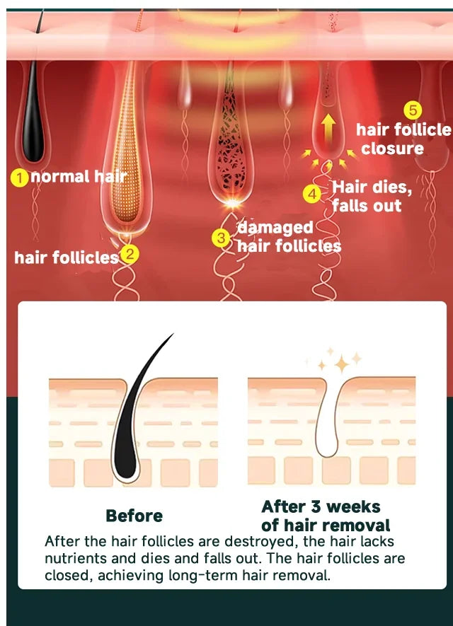 IPL Laser Hair Removal Device