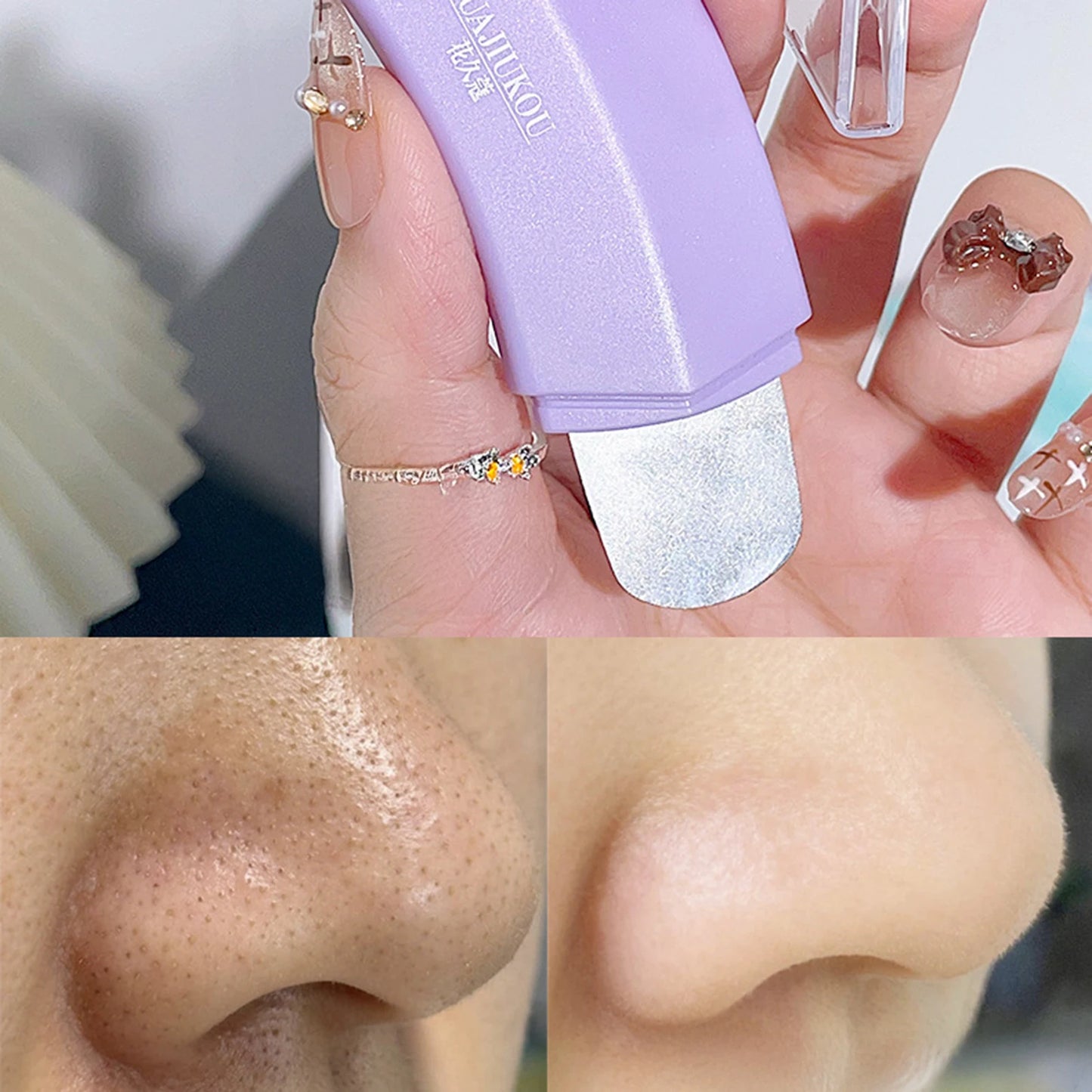 Blackhead Remover Tool