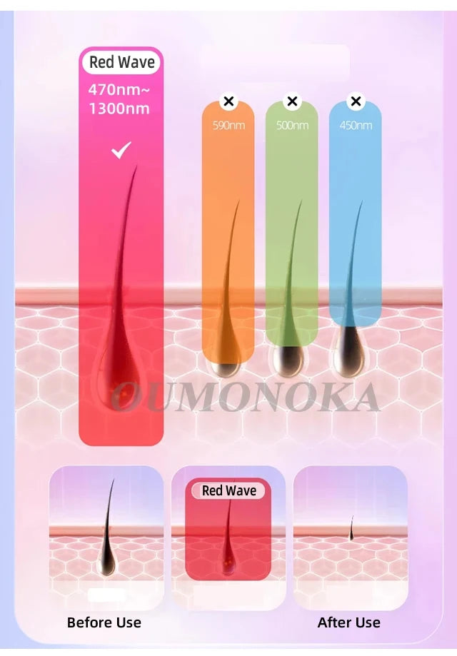 IPL Laser Hair Removal Device
