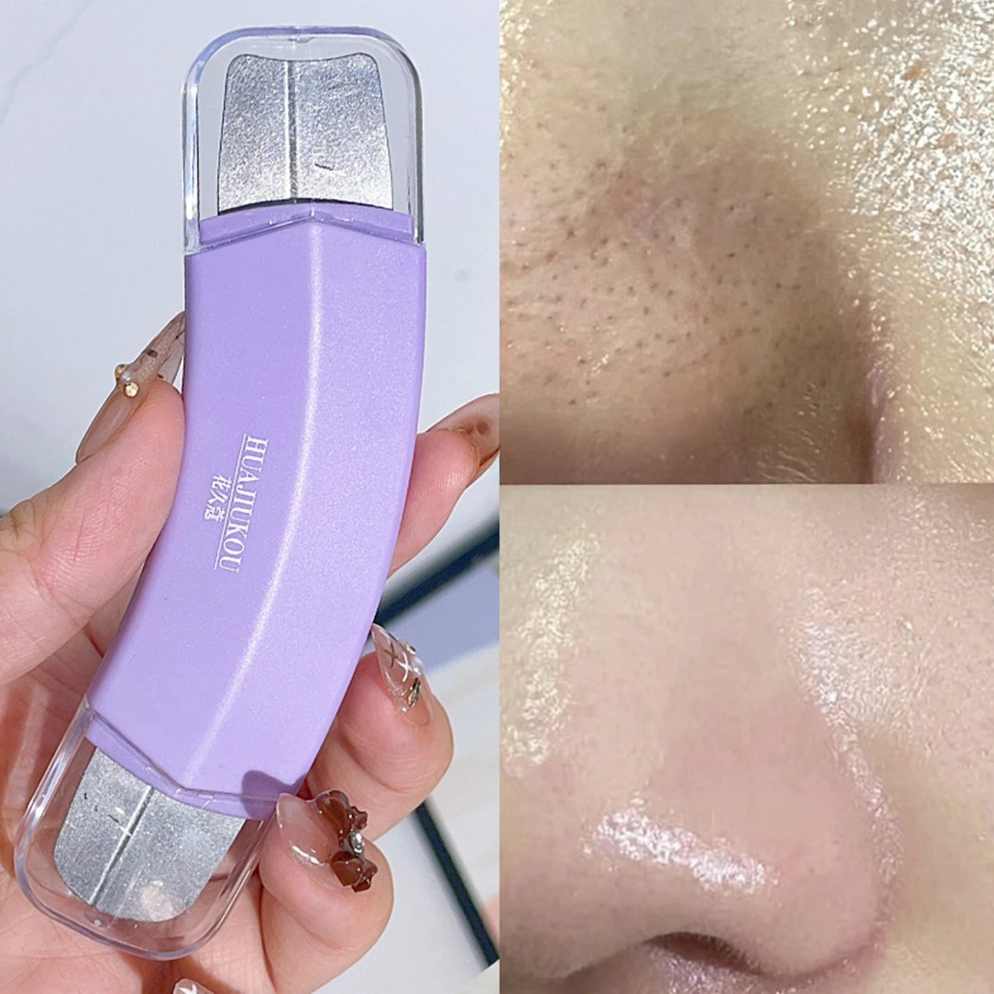 Blackhead Remover Tool