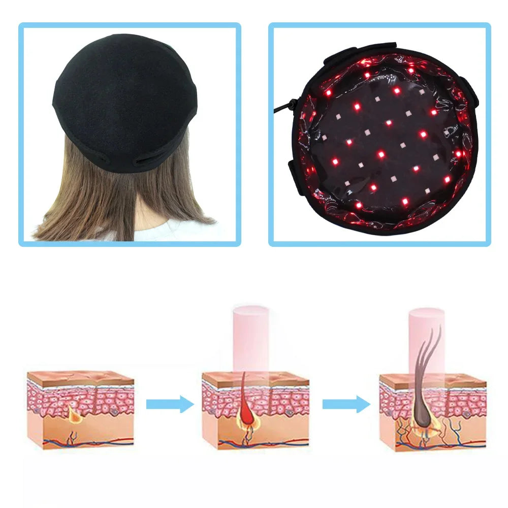 LED Red Light Therapy Massage Cap For Preventing Hair Loss Used For Professional Treatment Of Hair Loss Growth