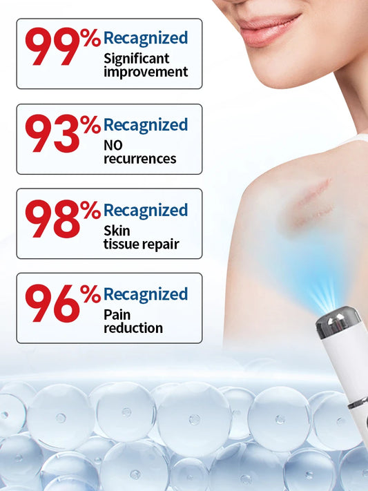 Scar blue light tool Set Can says Goodbye To Flat scars Filiform scars