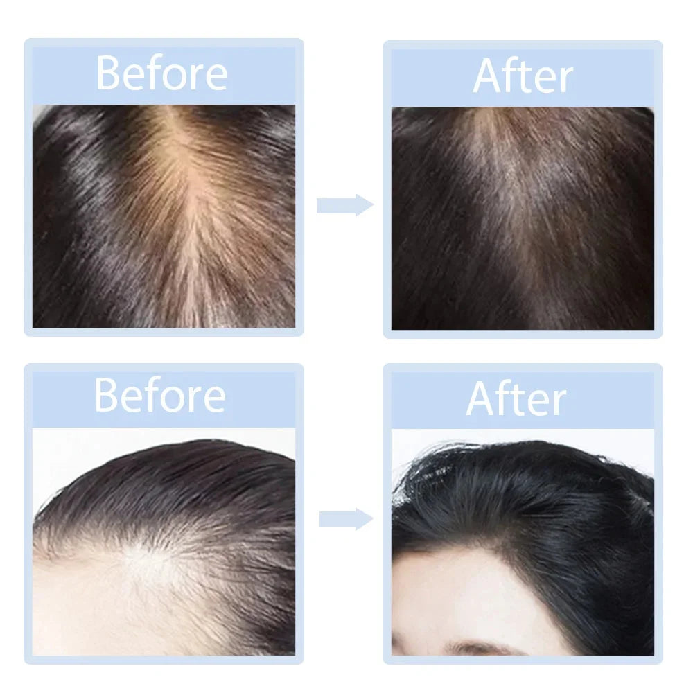 LED Red Light Therapy Massage Cap For Preventing Hair Loss Used For Professional Treatment Of Hair Loss Growth