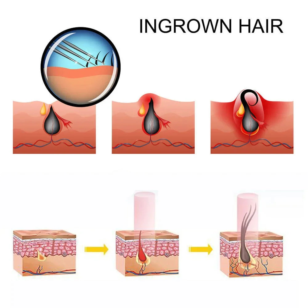 LED Red Light Therapy Massage Cap For Preventing Hair Loss Used For Professional Treatment Of Hair Loss Growth
