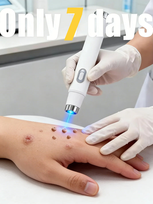 Portable Laser Pen Skin Smoothing Beauty Device