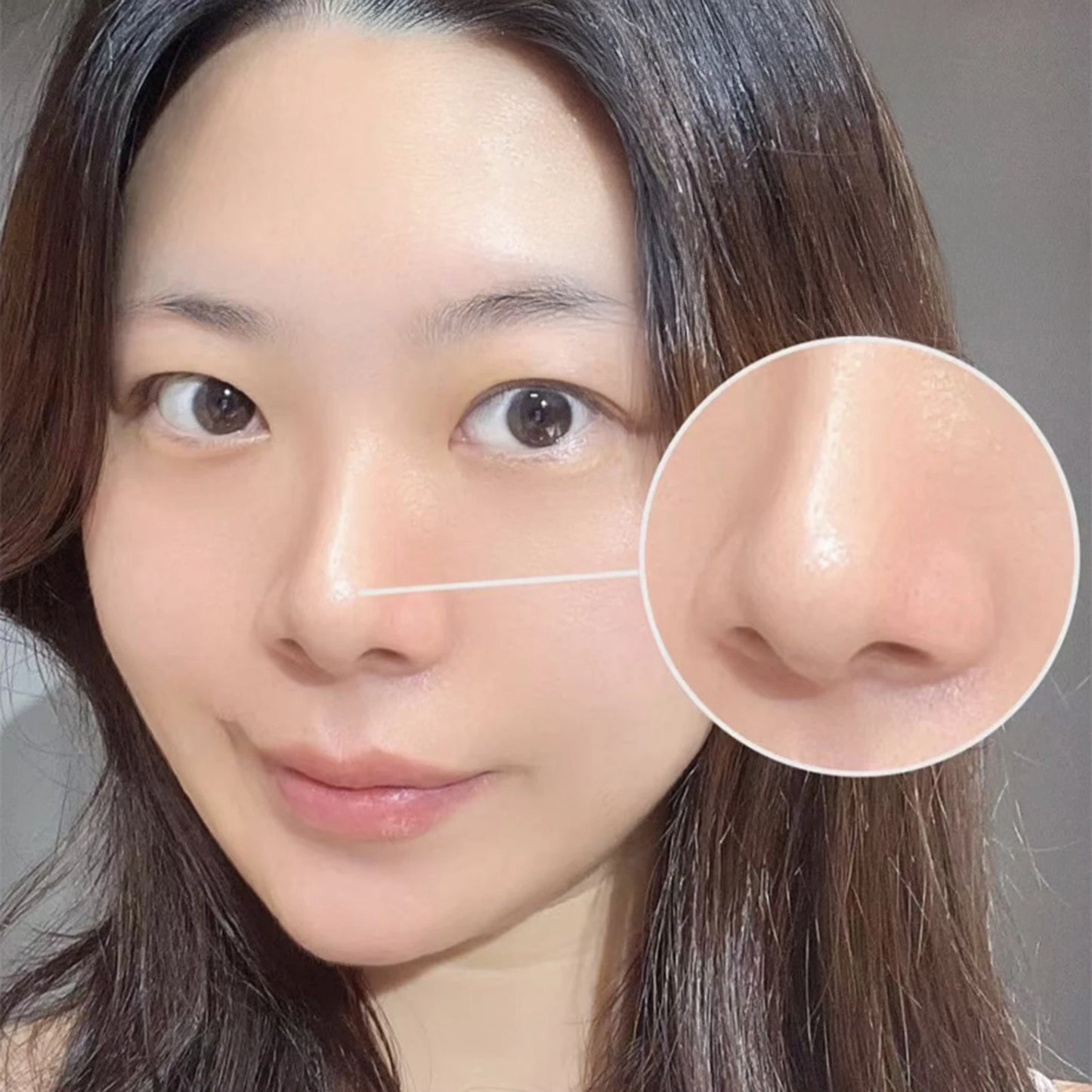 Blackhead Remover Tool
