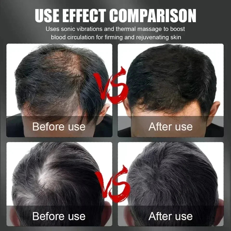 LED Hair Growth Cap